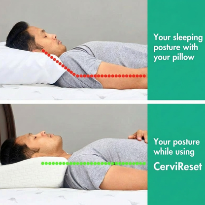 CerviRest